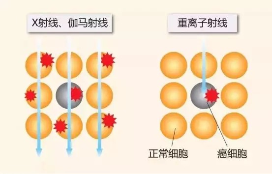 質(zhì)子重離子技術(shù)醫(yī)療險可以報銷嗎？